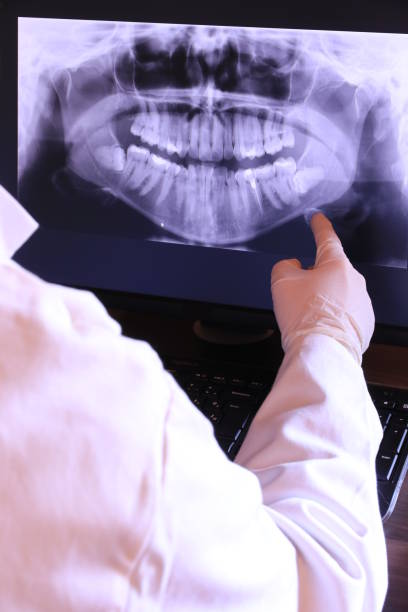 Best Emergency Tooth Extraction in Toro Nyon, CA