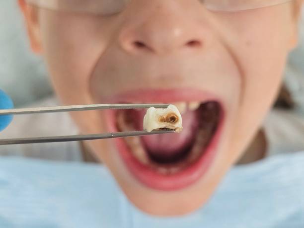 Best Weekend Emergency Dentist in Toro Nyon, CA
